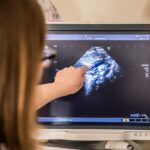 La Menace d’Accouchement Prématuré ou MAP