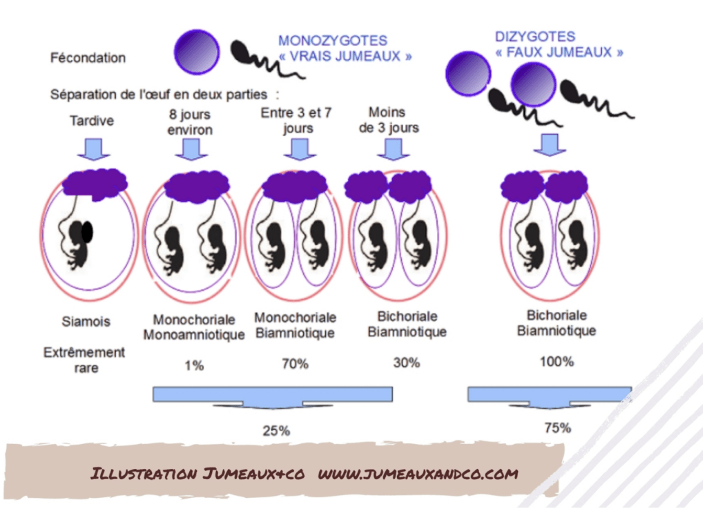 Être enceinte de jumeaux