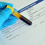 L’évolution du taux de Bêta HCG
