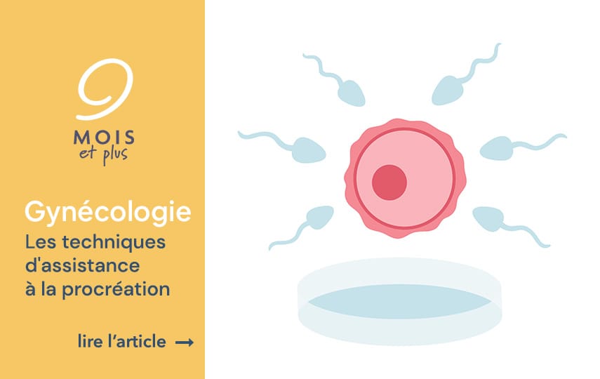 Les techniques d'assistance médicale à la procréation (AMP) - 9moisetplus