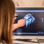 La Menace d’Accouchement Prématuré ou MAP