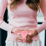 La descente d'organe / prolapsus génital